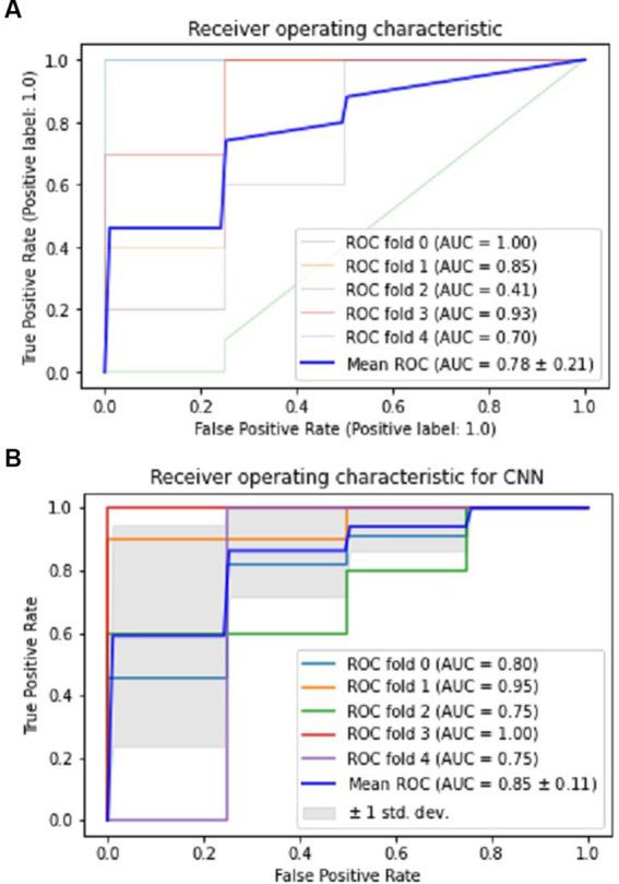 https://cdn.ncbi.nlm.nih.gov/pmc/blobs/42d8/10273207/1fc3d0ac18fa/fneur-14-1195923-g003.jpg