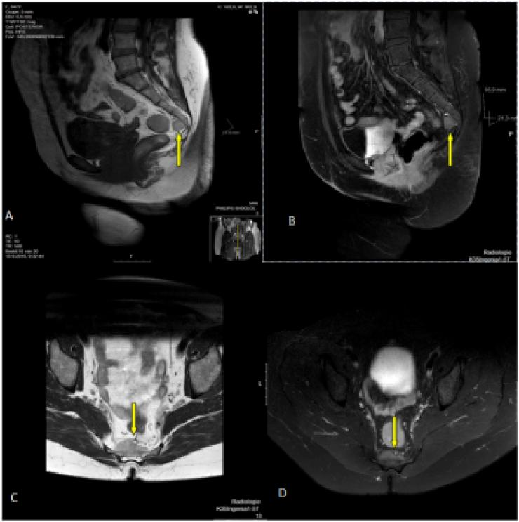 https://cdn.ncbi.nlm.nih.gov/pmc/blobs/42dd/7452051/9e0c158dd163/gr1.jpg