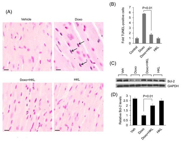 https://cdn.ncbi.nlm.nih.gov/pmc/blobs/42e4/5470953/7ab96bad7bfb/oncotarget-08-34082-g005.jpg