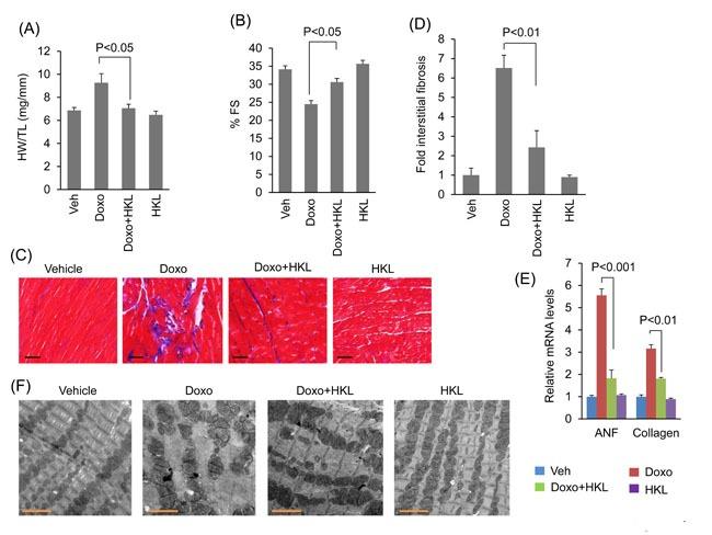 https://cdn.ncbi.nlm.nih.gov/pmc/blobs/42e4/5470953/bec9a5bb731a/oncotarget-08-34082-g004.jpg