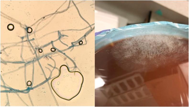 https://cdn.ncbi.nlm.nih.gov/pmc/blobs/42e5/7240283/d3ad95c94249/gr3.jpg