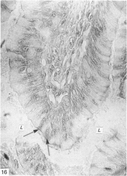 https://cdn.ncbi.nlm.nih.gov/pmc/blobs/42ec/1165086/190da66ba879/janat00196-0078-b.jpg