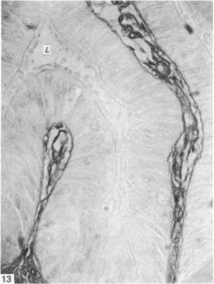 https://cdn.ncbi.nlm.nih.gov/pmc/blobs/42ec/1165086/4adc355d2365/janat00196-0077-b.jpg