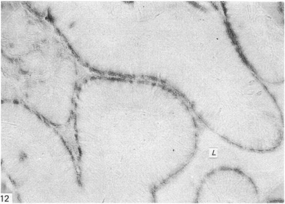 https://cdn.ncbi.nlm.nih.gov/pmc/blobs/42ec/1165086/55c57f5959a6/janat00196-0077-a.jpg