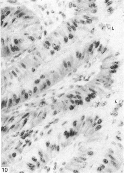 https://cdn.ncbi.nlm.nih.gov/pmc/blobs/42ec/1165086/72e986ad3923/janat00196-0075-c.jpg