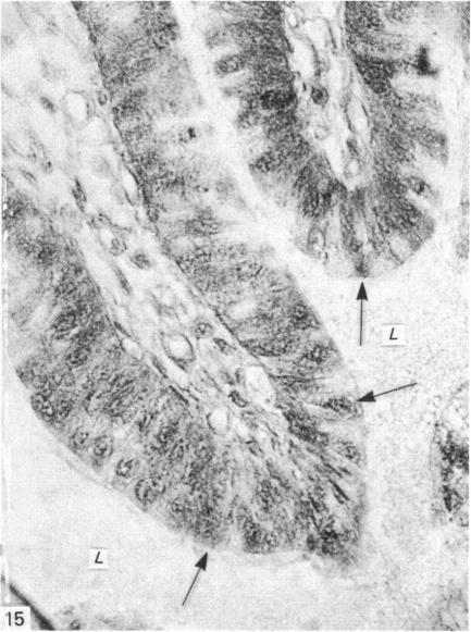 https://cdn.ncbi.nlm.nih.gov/pmc/blobs/42ec/1165086/eec0535eea9a/janat00196-0078-a.jpg