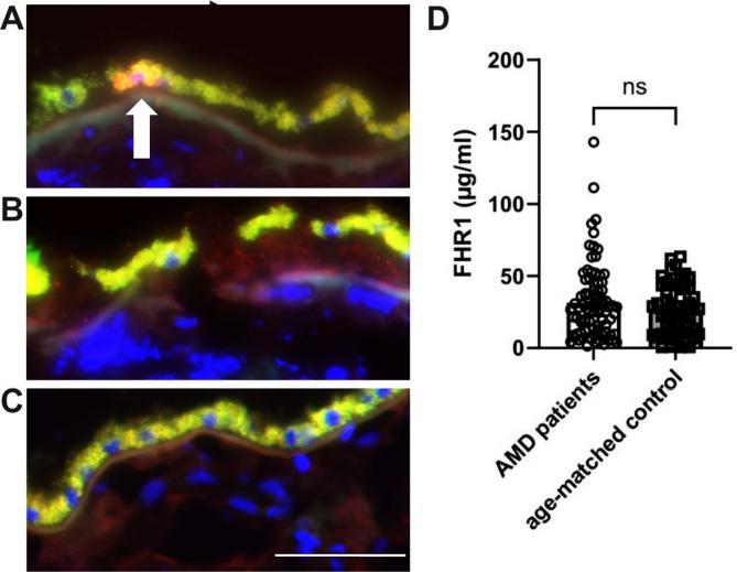 https://cdn.ncbi.nlm.nih.gov/pmc/blobs/42ec/12226897/1869620f91fa/12974_2025_3499_Fig1_HTML.jpg