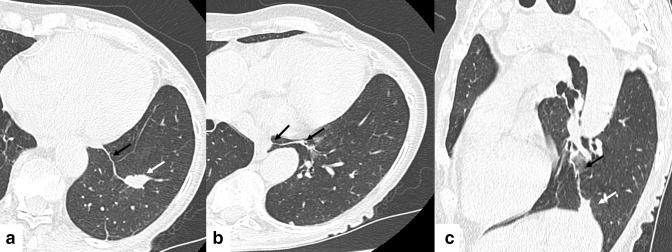 https://cdn.ncbi.nlm.nih.gov/pmc/blobs/42f1/9809917/ac9492bcc4d1/bjrcr.20220087.g003.jpg