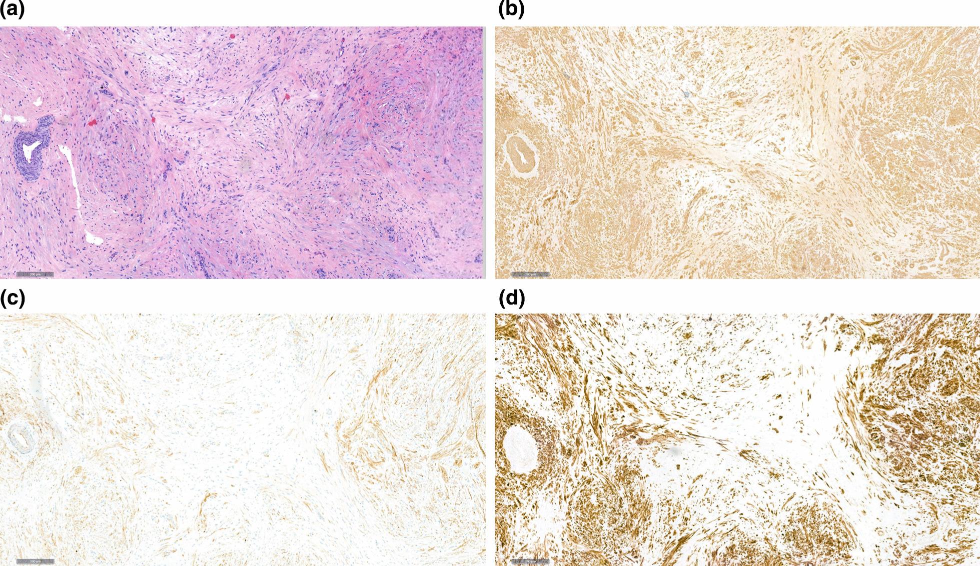 https://cdn.ncbi.nlm.nih.gov/pmc/blobs/42f6/10882757/fcd029786ab2/13256_2024_4393_Fig3_HTML.jpg