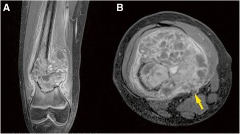 https://cdn.ncbi.nlm.nih.gov/pmc/blobs/4301/5116157/ed8fdb14568f/12957_2016_1037_Fig1_HTML.jpg