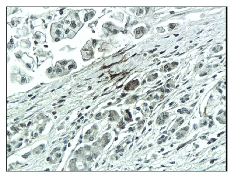 https://cdn.ncbi.nlm.nih.gov/pmc/blobs/4305/5474271/2656ad520418/DM2017-3276806.002.jpg