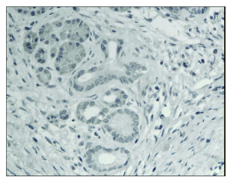 https://cdn.ncbi.nlm.nih.gov/pmc/blobs/4305/5474271/64ac8b038fbe/DM2017-3276806.005.jpg