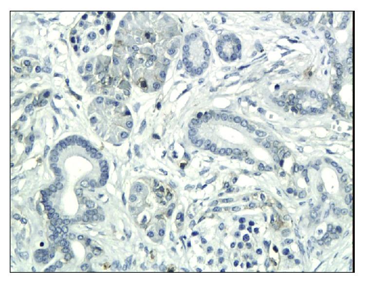 https://cdn.ncbi.nlm.nih.gov/pmc/blobs/4305/5474271/75de417af7e1/DM2017-3276806.003.jpg