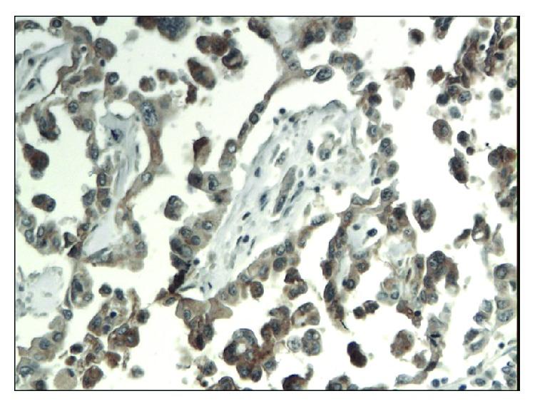 https://cdn.ncbi.nlm.nih.gov/pmc/blobs/4305/5474271/db4e2d8c9c27/DM2017-3276806.006.jpg