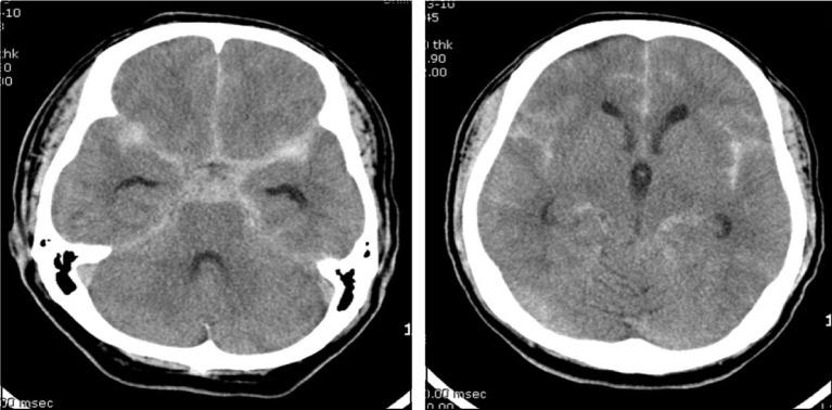 https://cdn.ncbi.nlm.nih.gov/pmc/blobs/430a/3471248/63b19e934c13/jcen-14-44-g001.jpg