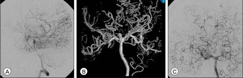 https://cdn.ncbi.nlm.nih.gov/pmc/blobs/430a/3471248/8ce6fe720d14/jcen-14-44-g003.jpg