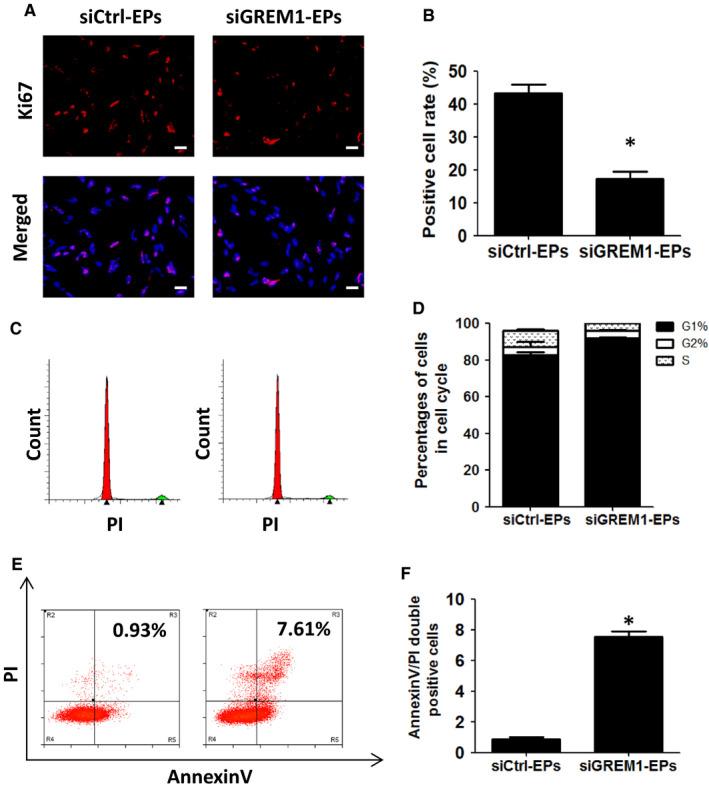 https://cdn.ncbi.nlm.nih.gov/pmc/blobs/430a/7348142/437f73af6f2a/JCMM-24-8018-g005.jpg