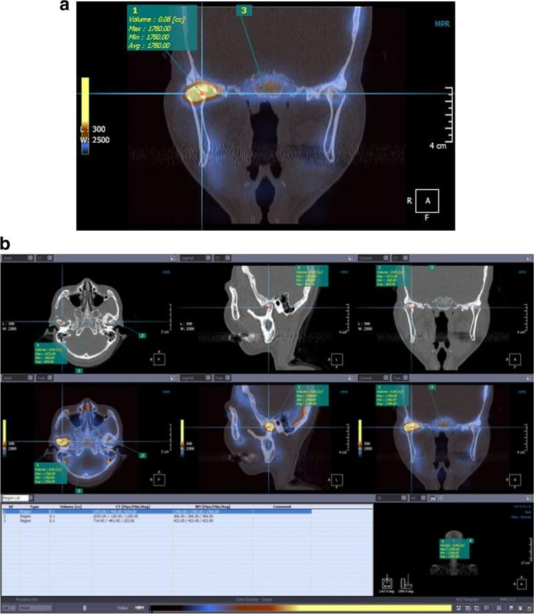 https://cdn.ncbi.nlm.nih.gov/pmc/blobs/430b/10533429/b2392250ad88/40902_2023_399_Fig2_HTML.jpg