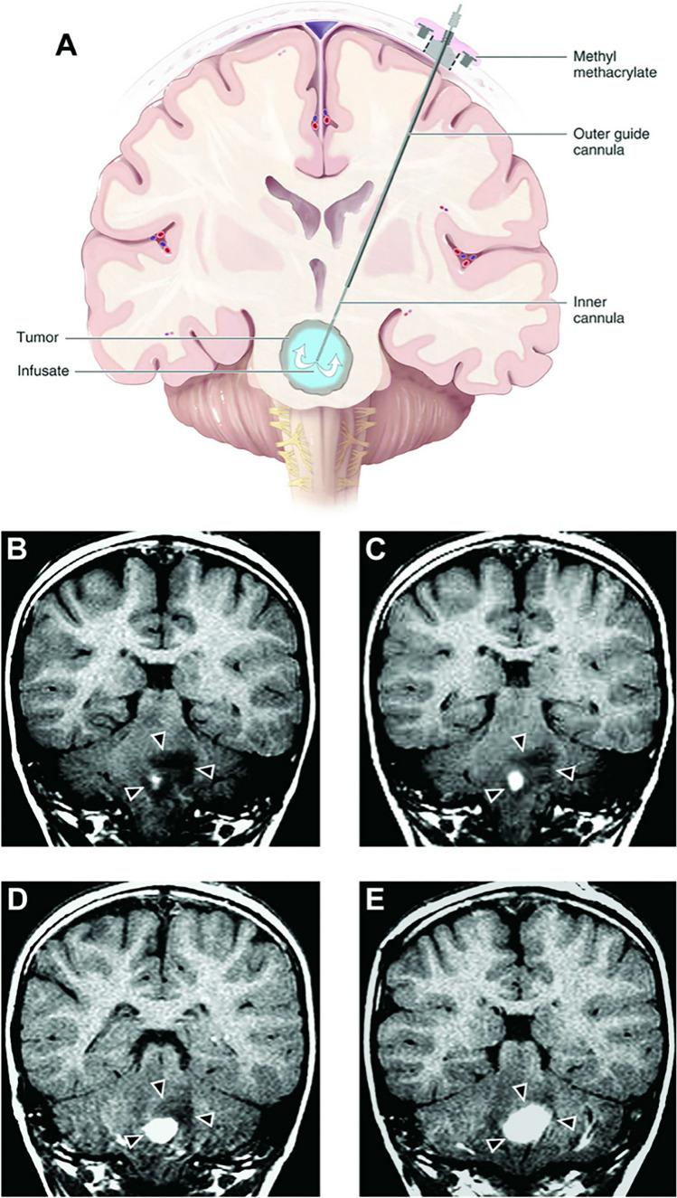 https://cdn.ncbi.nlm.nih.gov/pmc/blobs/430c/10834622/e47d2630a6a3/11060_2023_4552_Fig2_HTML.jpg