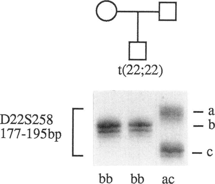 https://cdn.ncbi.nlm.nih.gov/pmc/blobs/430d/1918072/0f9f9a9b8b2c/ajhg00046-0026-a.jpg