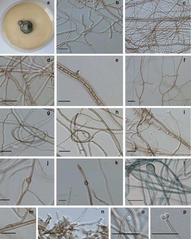 https://cdn.ncbi.nlm.nih.gov/pmc/blobs/4313/5125572/aaf14f15df56/pntd.0005102.g005.jpg