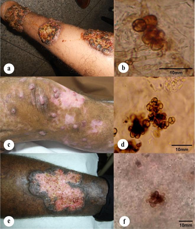 https://cdn.ncbi.nlm.nih.gov/pmc/blobs/4313/5125572/fdd0c1fec366/pntd.0005102.g006.jpg