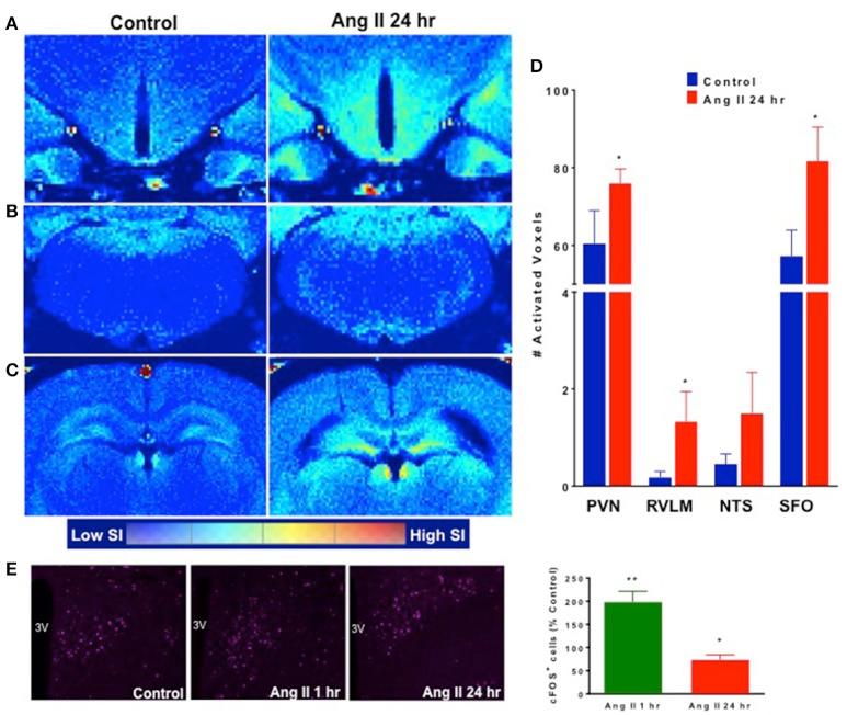 https://cdn.ncbi.nlm.nih.gov/pmc/blobs/4316/5583219/d75528eb701a/fphys-08-00592-g0005.jpg