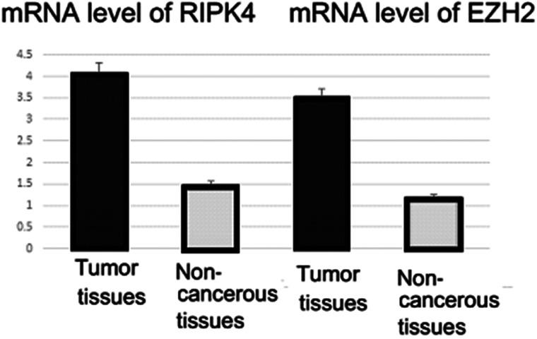 https://cdn.ncbi.nlm.nih.gov/pmc/blobs/431b/7841057/8589ae266e0b/OR-25-495-g003.jpg