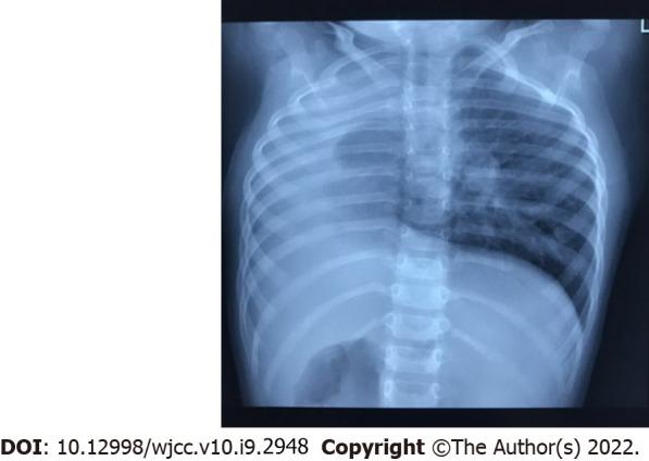 https://cdn.ncbi.nlm.nih.gov/pmc/blobs/4324/8968792/f4dd78c58c8a/WJCC-10-2948-g002.jpg
