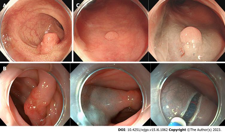 https://cdn.ncbi.nlm.nih.gov/pmc/blobs/4328/10302994/40a8bd9f430e/WJGO-15-1062-g002.jpg