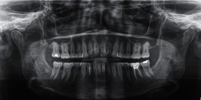 https://cdn.ncbi.nlm.nih.gov/pmc/blobs/4328/9463015/9b1091c12d31/CRID2022-3100360.006.jpg