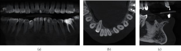 https://cdn.ncbi.nlm.nih.gov/pmc/blobs/4328/9463015/beb57abf3558/CRID2022-3100360.002.jpg
