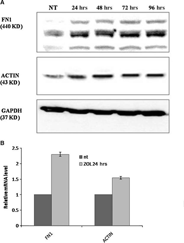 https://cdn.ncbi.nlm.nih.gov/pmc/blobs/432a/3822988/7a70ca920871/jcmm0016-2186-f4.jpg