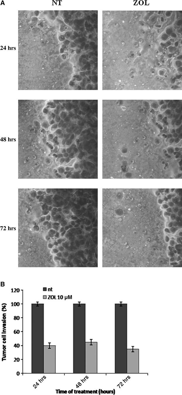 https://cdn.ncbi.nlm.nih.gov/pmc/blobs/432a/3822988/a51f302eb3b2/jcmm0016-2186-f5.jpg