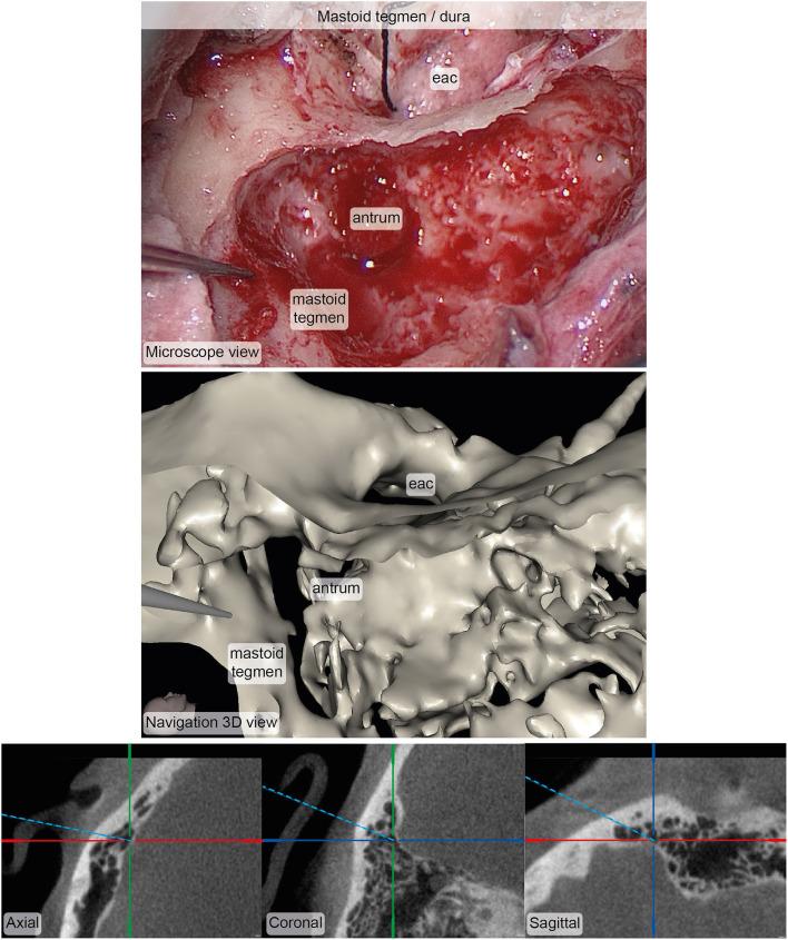 https://cdn.ncbi.nlm.nih.gov/pmc/blobs/432b/8529212/cc89ca7138ed/fsurg-08-742112-g0007.jpg