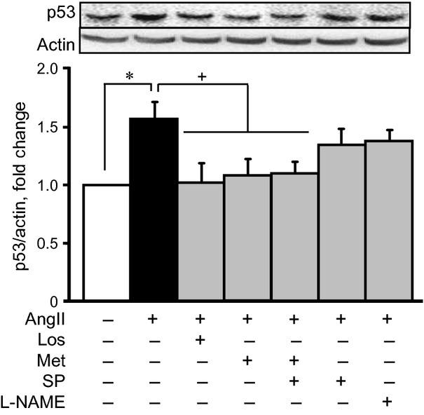 https://cdn.ncbi.nlm.nih.gov/pmc/blobs/4330/4000121/32235b16e094/jcmm0018-0709-f6.jpg