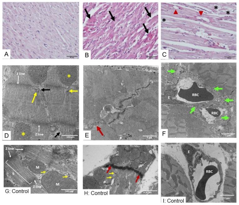 https://cdn.ncbi.nlm.nih.gov/pmc/blobs/4337/11769258/99819f3d3f28/toxins-17-00010-g002.jpg