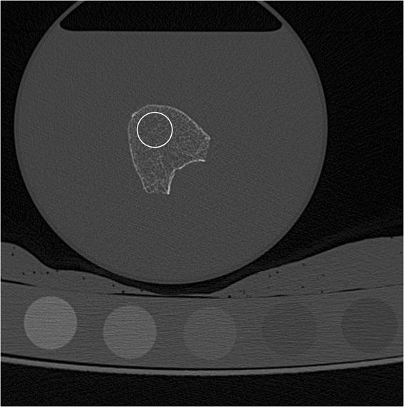 https://cdn.ncbi.nlm.nih.gov/pmc/blobs/4338/4482285/30bfcf4a4917/12880_2015_66_Fig1_HTML.jpg