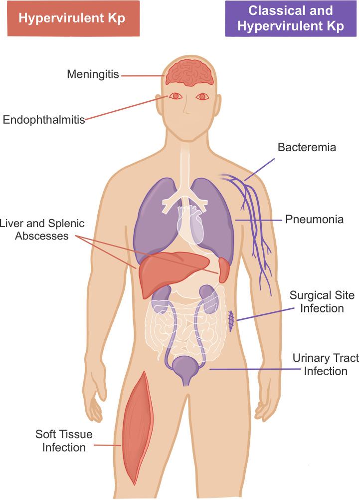 https://cdn.ncbi.nlm.nih.gov/pmc/blobs/4349/8090965/d3fd28d17181/IAI.00693-20-f0001.jpg