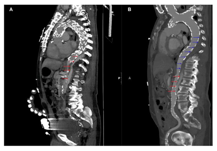 https://cdn.ncbi.nlm.nih.gov/pmc/blobs/434d/10831204/23396ce15c9e/cureus-0016-00000051522-i01.jpg