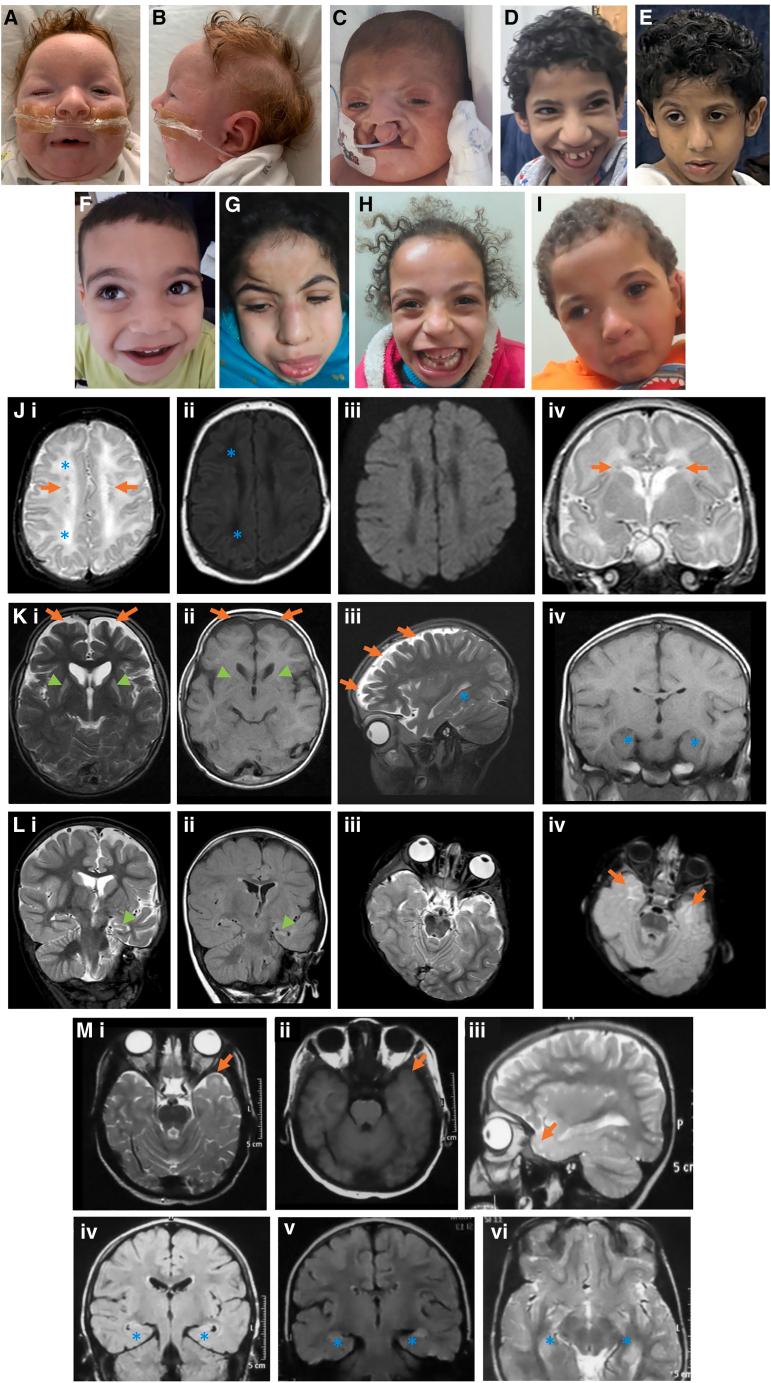 https://cdn.ncbi.nlm.nih.gov/pmc/blobs/434f/12120171/5ddd4bd520ea/gr3.jpg