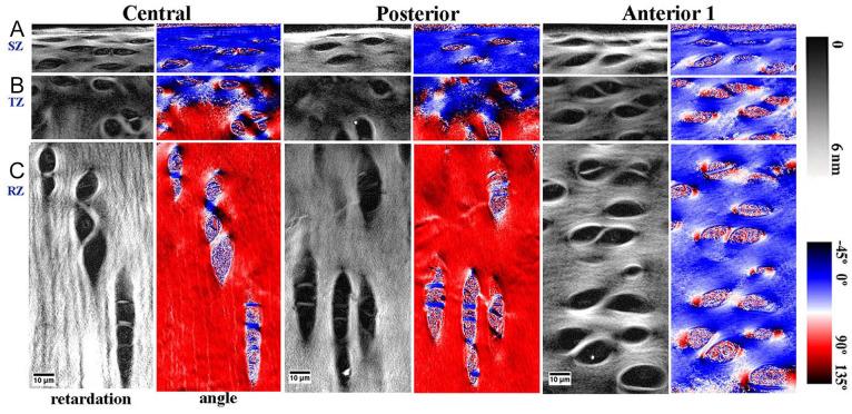 https://cdn.ncbi.nlm.nih.gov/pmc/blobs/434f/9137317/6f2f4686a1a6/10.1177_19476035221085143-fig7.jpg