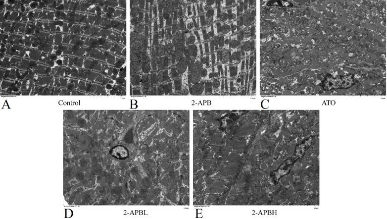 https://cdn.ncbi.nlm.nih.gov/pmc/blobs/4351/11090852/2e5efd0a8193/abbs-2023-581-t2.jpg