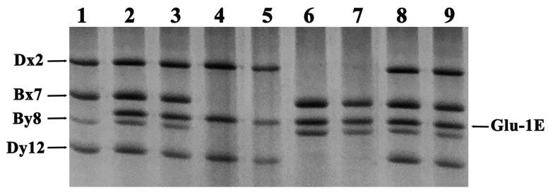 https://cdn.ncbi.nlm.nih.gov/pmc/blobs/4356/10341674/e3b5685ef626/ijms-24-11072-g001.jpg
