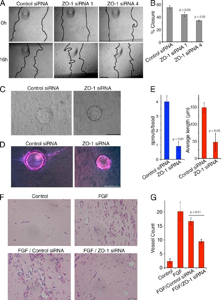 https://cdn.ncbi.nlm.nih.gov/pmc/blobs/4358/4362456/309fbcb1b3cd/JCB_201404140_Fig3.jpg
