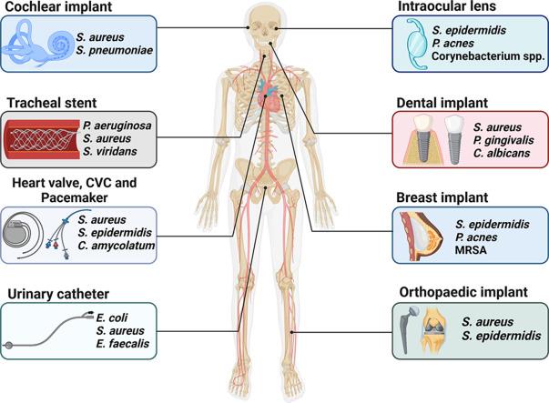 https://cdn.ncbi.nlm.nih.gov/pmc/blobs/435e/10951465/061c1c45705e/ga1.jpg