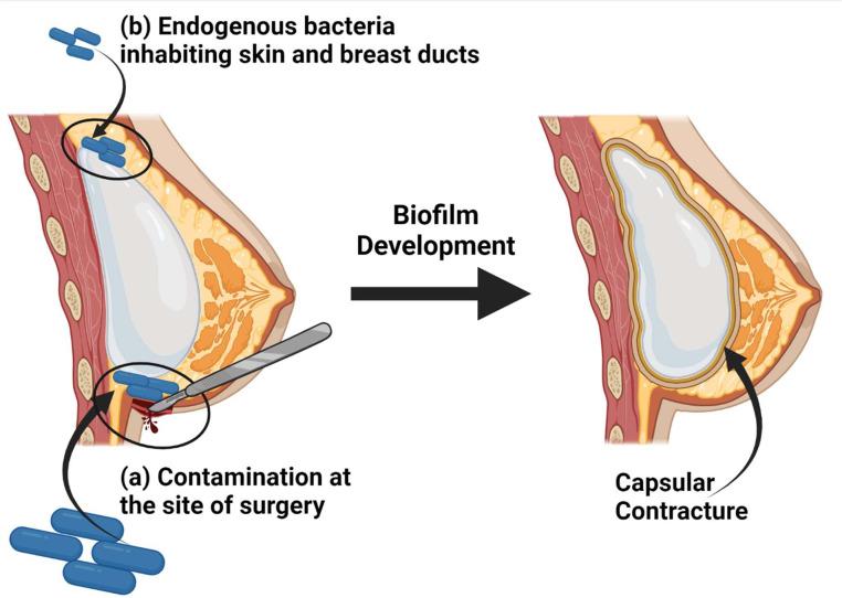 https://cdn.ncbi.nlm.nih.gov/pmc/blobs/435e/10951465/25c701e5cf81/gr5.jpg