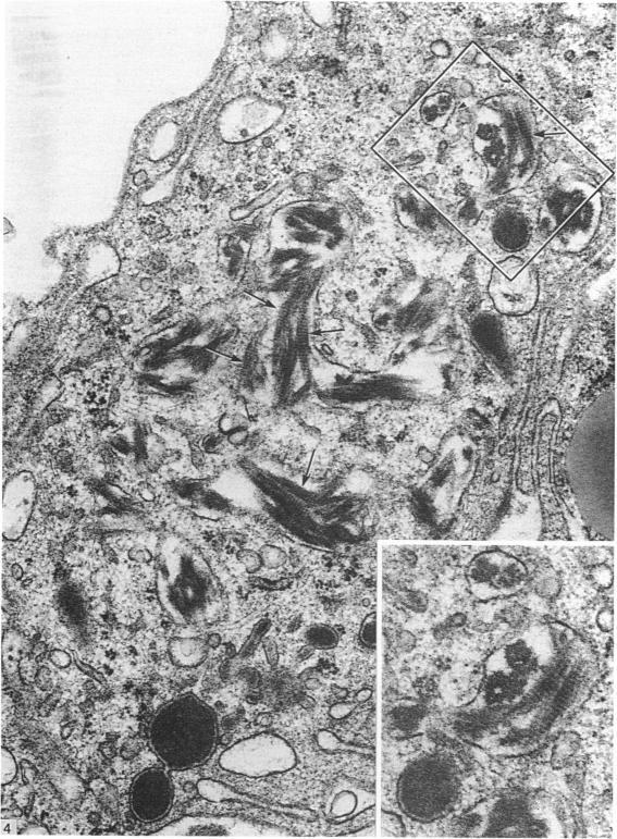 https://cdn.ncbi.nlm.nih.gov/pmc/blobs/4360/1261972/18ab52b53bff/janat00174-0015-a.jpg