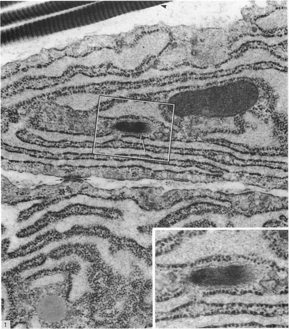 https://cdn.ncbi.nlm.nih.gov/pmc/blobs/4360/1261972/6f435fdba475/janat00174-0012-a.jpg