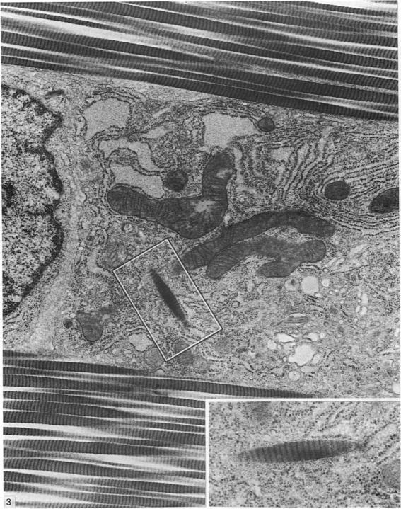 https://cdn.ncbi.nlm.nih.gov/pmc/blobs/4360/1261972/e6ee99e3a9b4/janat00174-0014-a.jpg